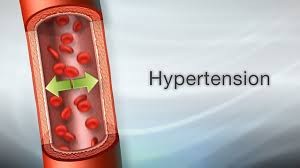 High Arterial Pressure  Understanding and Managing the Condition